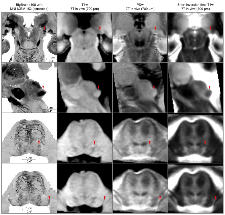 Figure 5—figure supplement 1.