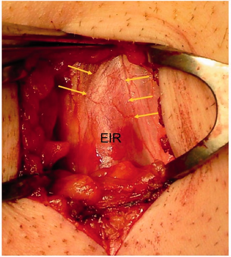 Fig 1. 