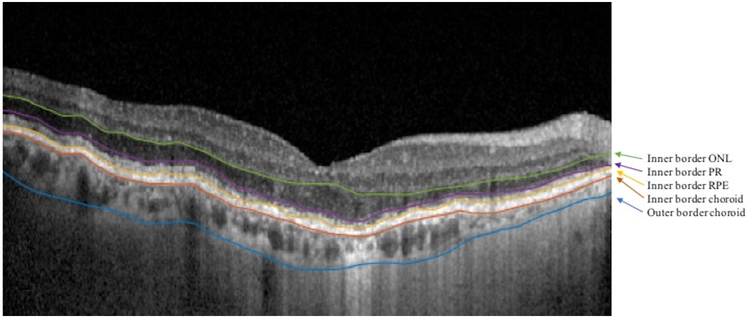 Figure 1: