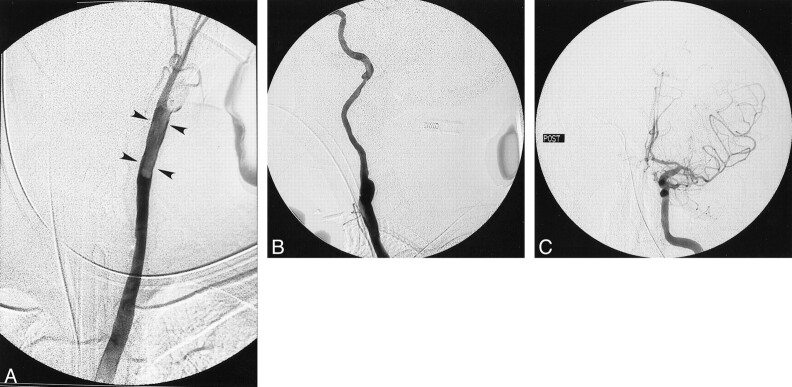 fig 2.