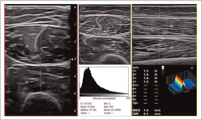 FIGURE 2