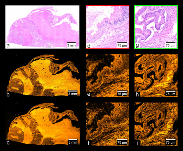 Figure 11: