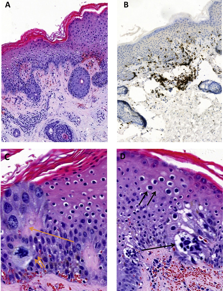 Fig. 2