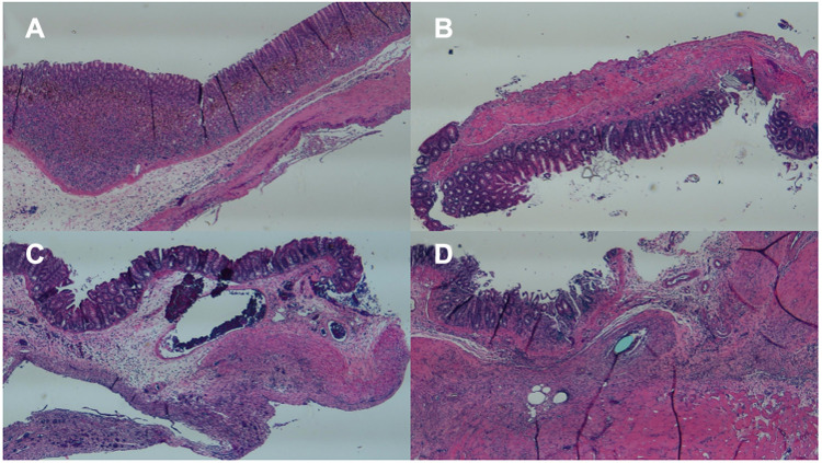 Figure 10