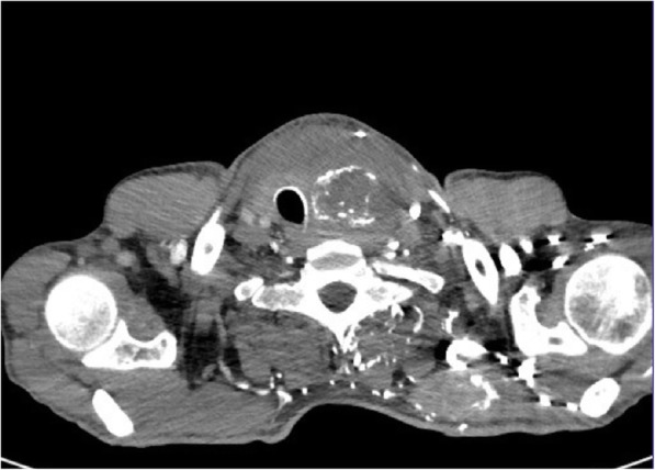 Fig. 5