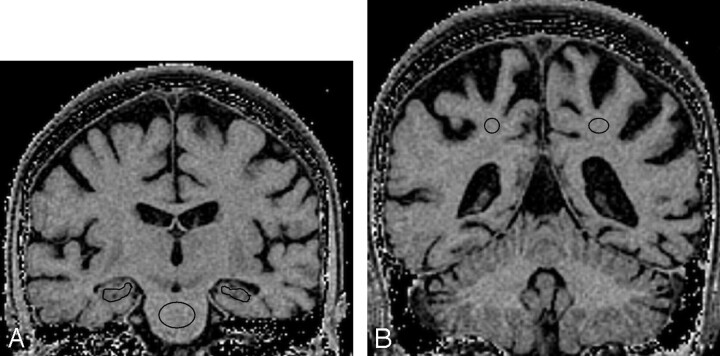 Fig 1.