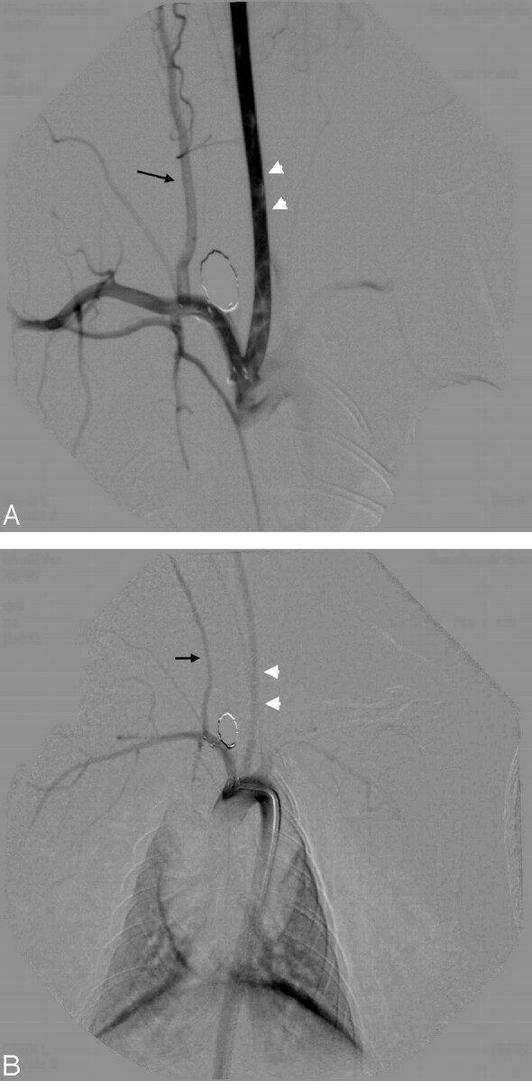 Fig 2.