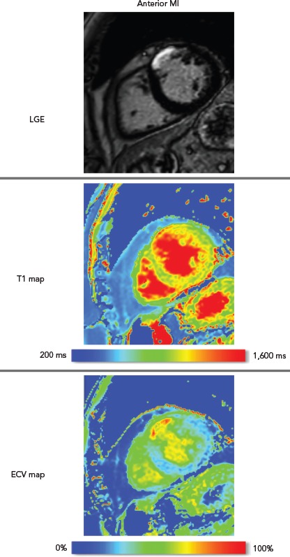 Figure 1: