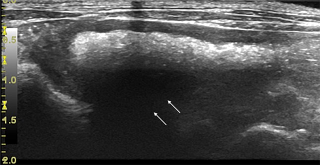 Fig. 4