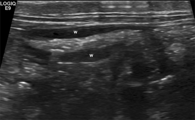 Fig. 2