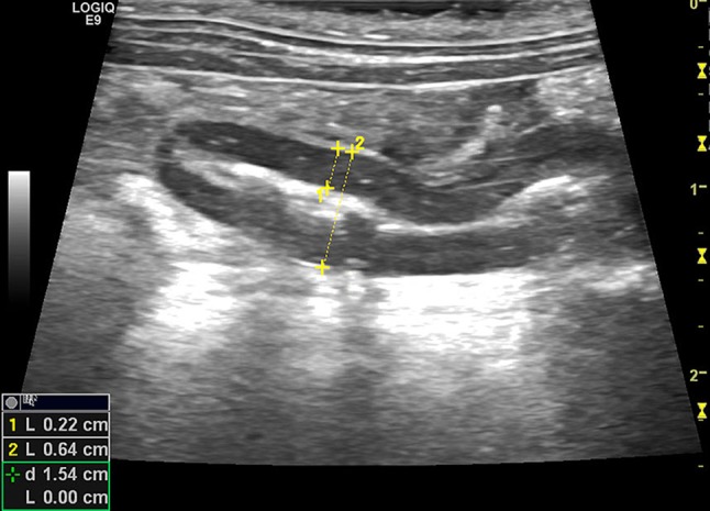 Fig. 1