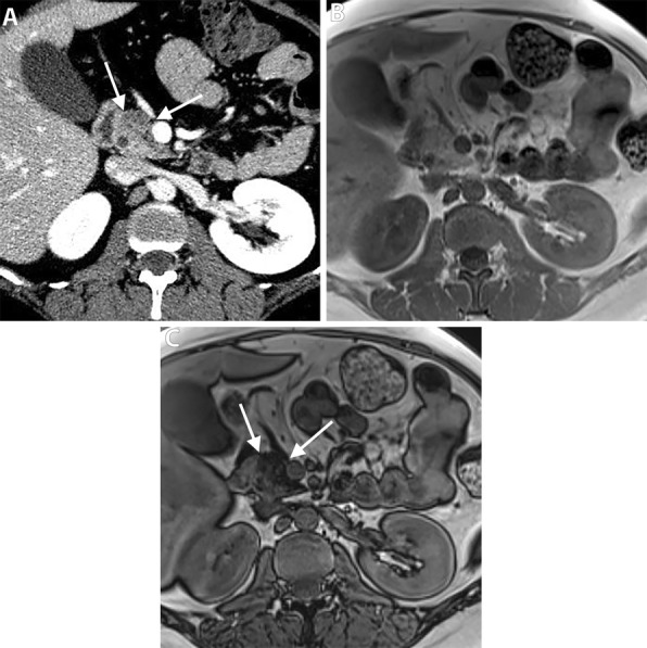 Fig. 12