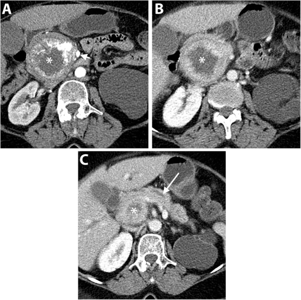 Fig. 13