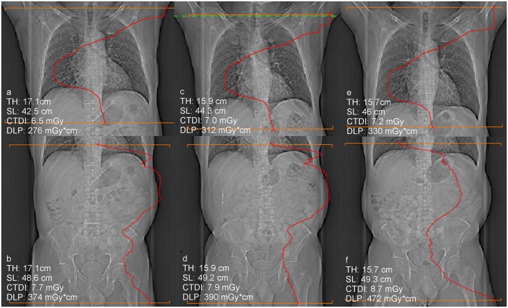 Fig 3