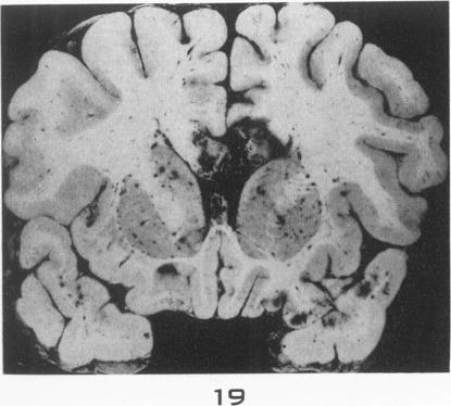 Fig. 19