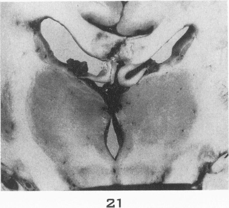 Fig. 21