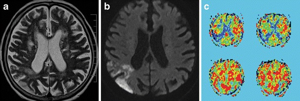 Fig. 7