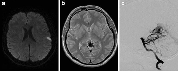 Fig. 3