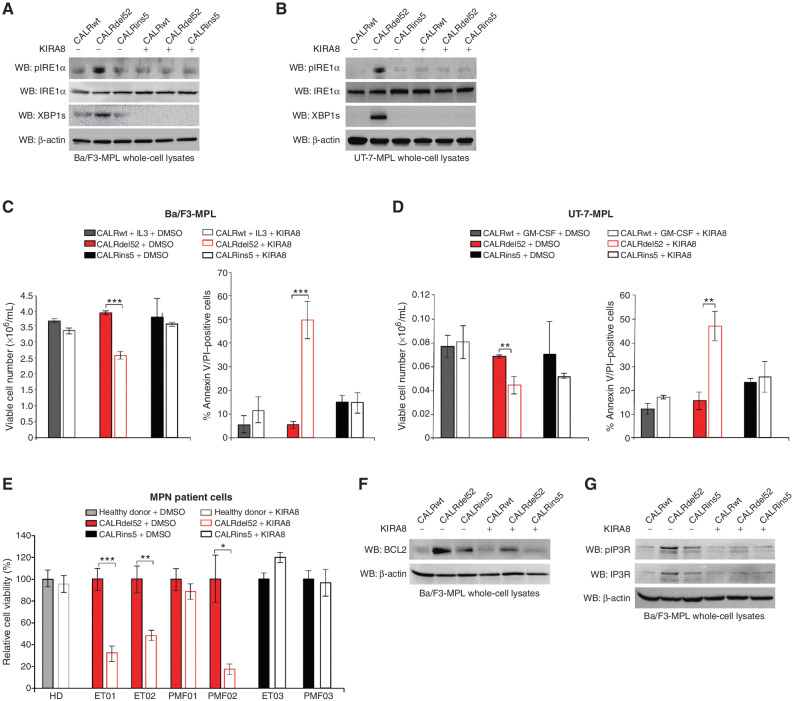 Figure 6. The IRE1α/XBP1 pathway represents a potential target for therapy in CALRdel52-driven MPNs. A, Western blot analysis for phospho-IRE1α, total IRE1α and XBP1s in Ba/F3-MPL cells expressing calreticulin (CALR) variants treated with or without KIRA8 (5 μmol/L for 4 hours). β-Actin was used as a loading control. B, Western blot analysis for phospho-IRE1α, total IRE1α, and XBP1s in UT-7-MPL cells expressing CALR variants treated with or without KIRA8 (5 μmol/L for 4 hours). β-Actin was used as a loading control. C, Left, total viable cell number at 72 hours post IL3 withdrawal in Ba/F3-MPL cells expressing CALR variants treated with or without KIRA8 (5 μmol/L). Right, quantification of flow cytometric analysis for Annexin V/PI double positivity in Ba/F3-MPL cells expressing CALR variants and treated with or without KIRA8 (5 μmol/L for 48 hours). Each bar represents the average of three independent replicates. Error bars, SD. Significance was determined by two-tailed Student t test (***, P < 0.001). D, Left, total viable cell number at 72 hours post GM-CSF withdrawal in UT-7-MPL cells expressing CALR variants treated with or without KIRA8 (5 μmol/L). Right, quantification of flow cytometric analysis for Annexin V/PI double positivity in UT-7-MPL cells expressing CALR variants and treated with or without KIRA8 (5 μmol/L for 48 hours). Each bar represents the average of three independent replicates. Error bars, SD. Significance was determined by two-tailed Student t test (**, P < 0.01). E, Relative cell viability in peripheral blood mononuclear cells from a healthy donor (HD) or patients with myeloproliferative neoplasms (MPN; patient number depicted below each bar) with CALRdel52 or CALRins5 mutations, treated with or without KIRA8 (500 nmol/L for 48 hours). Viability was determined by CellTiter-Glo assay. Each bar represents the average of three independent replicates. Error bars, SD. Significance was determined by two-tailed Student t test (*, P < 0.05; **, P < 0.01; ***, P < 0.001). F, Western blot analysis for BCL-2 in Ba/F3-MPL cells expressing CALR variants treated with or without KIRA8 (5 μmol/L for 24 hours). β-Actin was used as a loading control. G, Western blot analysis for IP3R in Ba/F3-MPL cells expressing CALR variants treated with or without KIRA8 (5 μmol/L for 24 hours). β-Actin was used as a loading control.