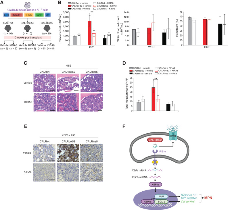 Figure 7. Inhibition of IRE1α signaling abrogates myeloproliferative neoplasm (MPN) disease progression in vivo. A, Schematic of retroviral bone marrow transplantation assay (BMT). B, Platelet counts (PLT; left), white blood cell counts (WBC; middle), and hematocrit (HCT; right) at 16 weeks posttransplantation in the peripheral blood of recipient mice receiving CALRwt, CALRdel52, or CALRins5-expressing c-KIT+ BM cells treated as indicated (n = 10 in each group). Each bar represents the average of 5 mice. Error bars, SD. Significance was determined by two-tailed Student t test (**, P < 0.01). C, Histopathologic hematoxylin and eosin (H&E) sections of BM from representative CALRwt, CALRdel52, and CALRins5 mice treated with vehicle or 50 mg/kg/day KIRA8 (20× magnification, black scale bars = 100 μm). D, Megakaryocyte counts per high-power field (HPF) in BM of CALRwt, CALRdel52, or CALRins5 mice treated with vehicle or 50 mg/kg/day KIRA8. Each bar represents the average of 5 mice. Error bars, SD. Significance was determined by two-tailed Student t test (**, P < 0.01). E, IHC analysis for XBP1 in BM from representative CALRwt, CALRdel52, and CALRins5 mice treated with vehicle or 50 mg/kg/day KIRA8 (40× magnification, black scale bars = 25 μm). F, Working model: left, type I CALRdel52 proteins exhibit loss of Ca2+ binding function. This leads to depleted ER Ca2+, which in turn activates the IRE1α/XBP1 pathway. XBP1 mediates upregulation of BCL-2, which promotes cell survival, and IP3R, which facilitates continued ER Ca2+ efflux to sustain ER Ca2+ depletion and activation of IRE1α/XBP1, ultimately driving MPN. Inhibiting this pathway leads to rapid cell death in vitro and abrogation of disease progression in vivo. Right, in contrast, CALRwt and CALRins5 cells retain calreticulin (CALR)-mediated ER Ca2+ binding function, and thus do not hijack IRE1α/XBP1 to promote survival. Instead, canonical IRE1α/XBP1 signaling in these cells may be activated upon ER stress, wherein this pathway would initially promote adaptation and survival to restore proteostasis, but commit cells to apoptosis if stress cannot be resolved (figure created with BioRender).