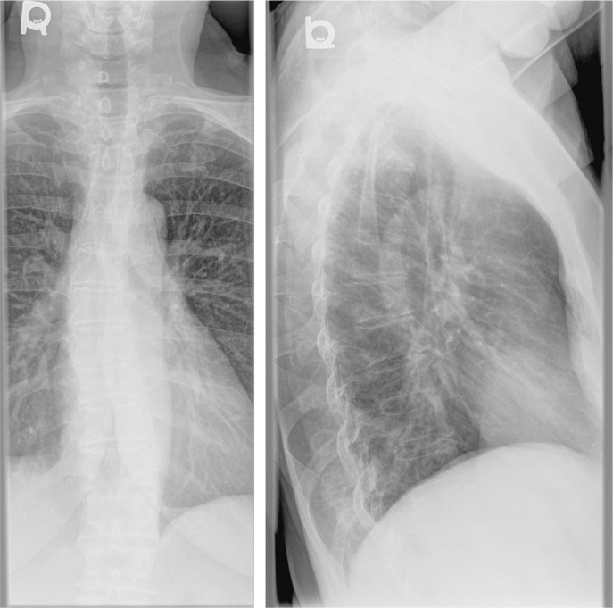 Figure 1A and 1B: