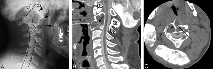 Fig 1.