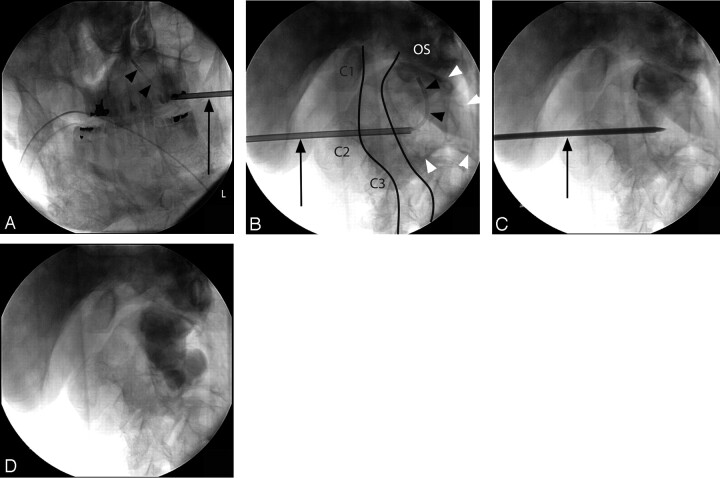 Fig 3.