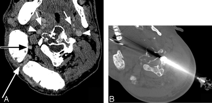 Fig 2.