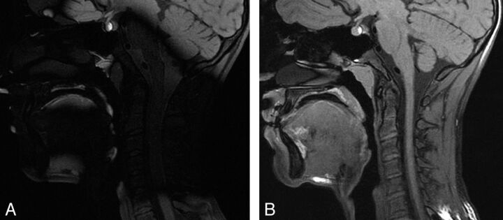 Fig 3.