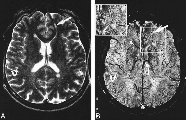 fig 2.