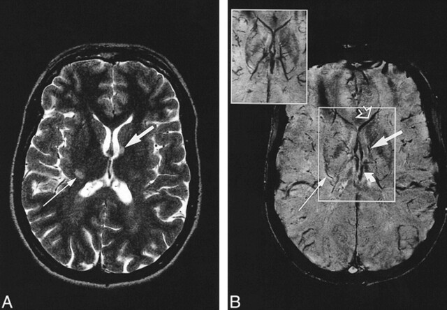 fig 1.