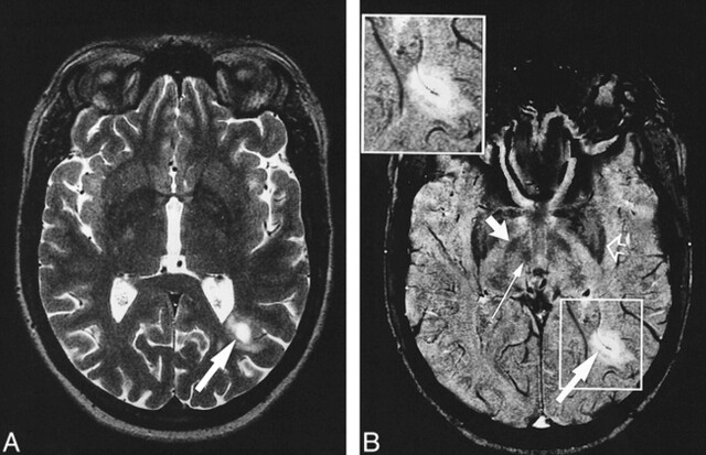 fig 3.