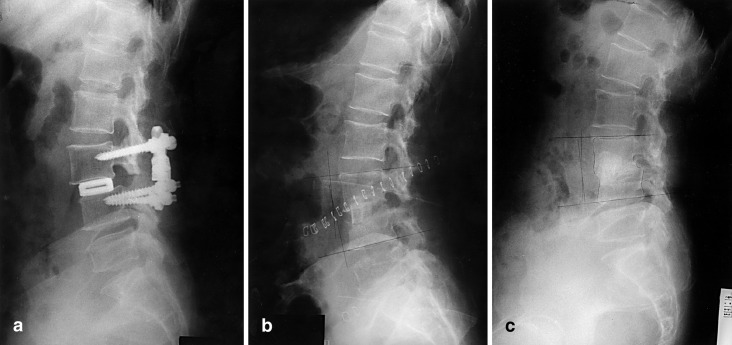 Fig. 4a–c