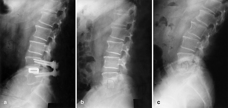 Fig. 3a–c