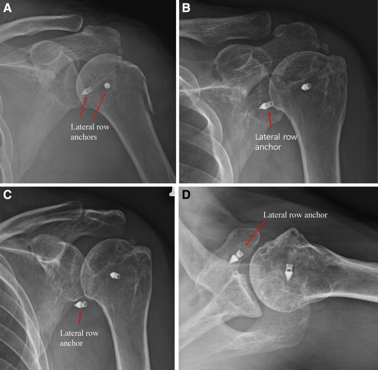 Fig 14