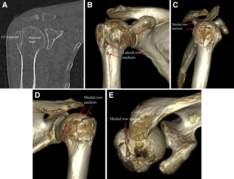 Fig 12