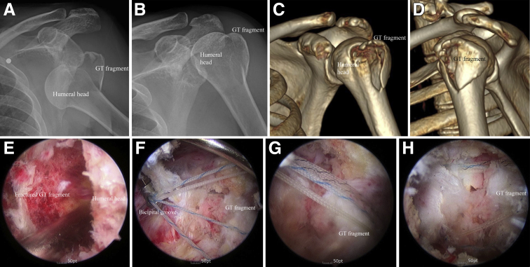 Fig 13