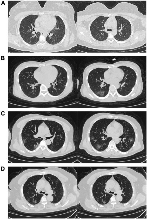 FIGURE 2