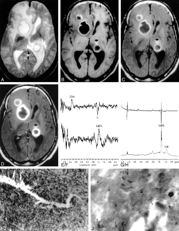 fig 2.