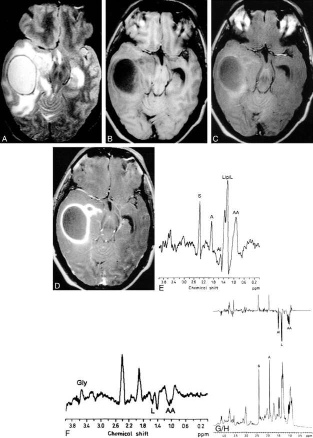 fig 1.