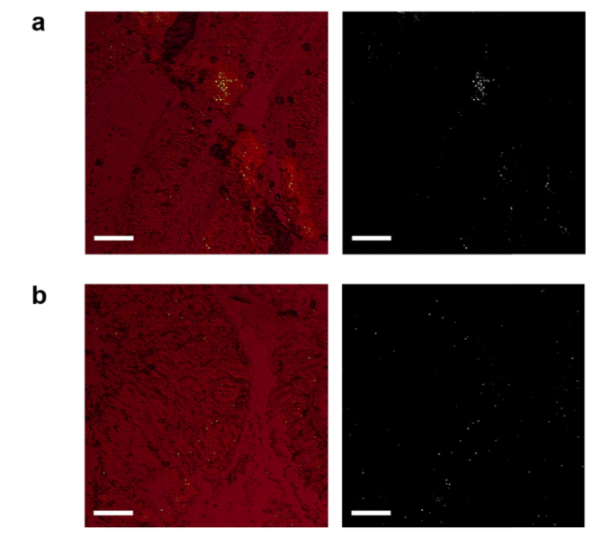 Fig. 11