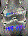 Fig. 15