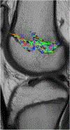 Fig. 18