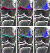 Fig. 17