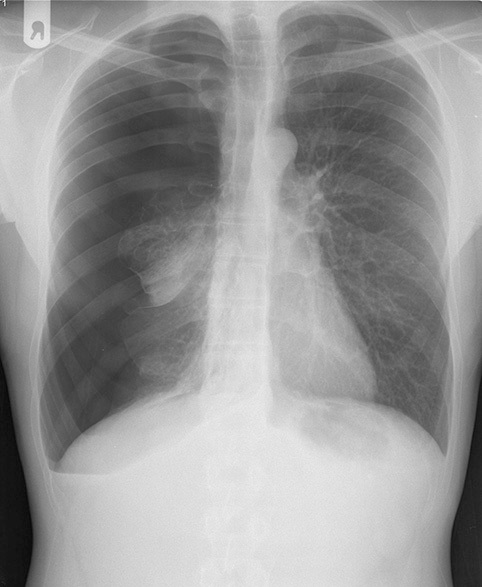 Beeldvormende diagnostiek - PMC