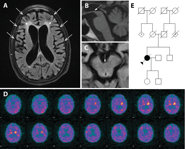 FIG 1