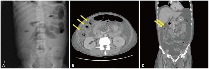 Fig. 2