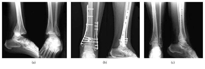 Figure 1