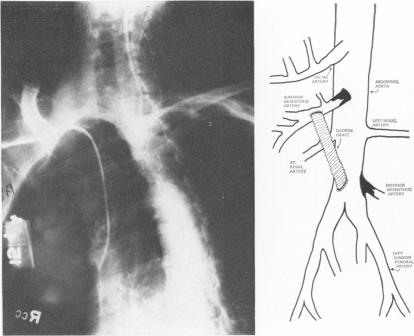 Fig. 2B (left)., Fig. 3 (right).