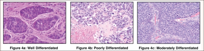 Figure 4: